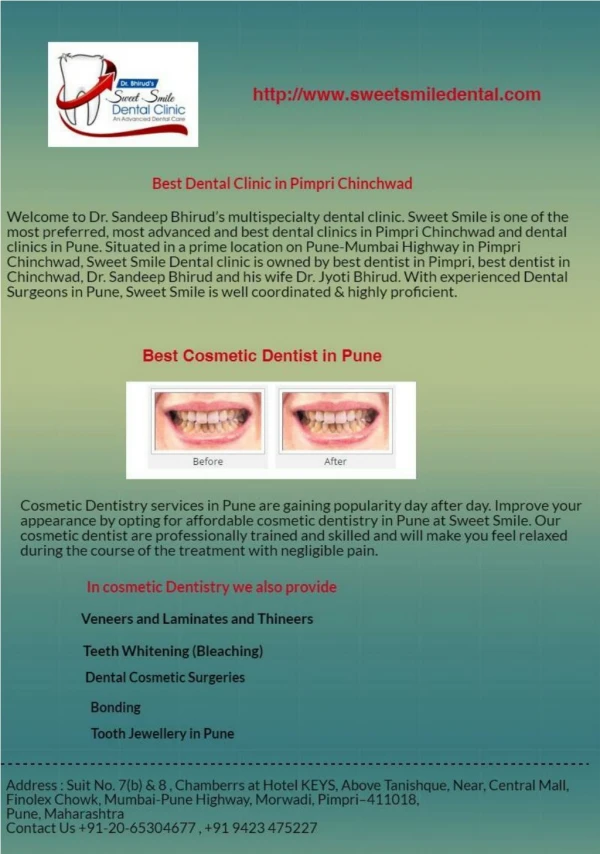 Cosmetic Dentistry in Pune | Sweet Smile Dental