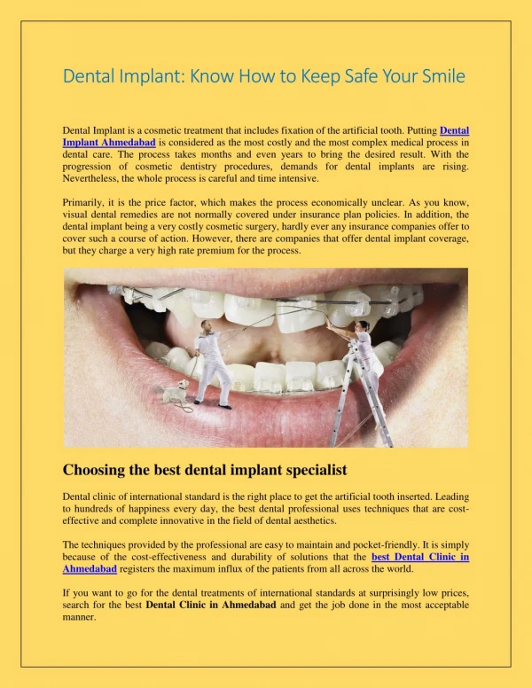 Dental Implant Know How to Keep Safe Your Smile