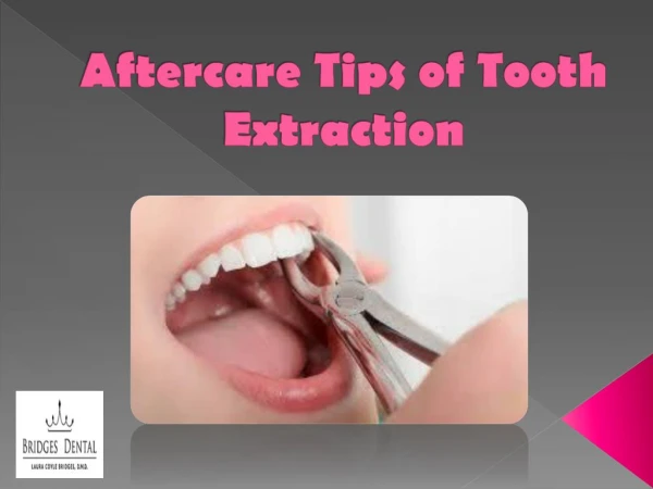 Best Aftercare Tips of Tooth Extraction by Brandon Dentist | Bridges Dental