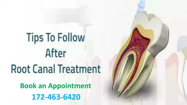 Tips to follow after Root Canal Treatment