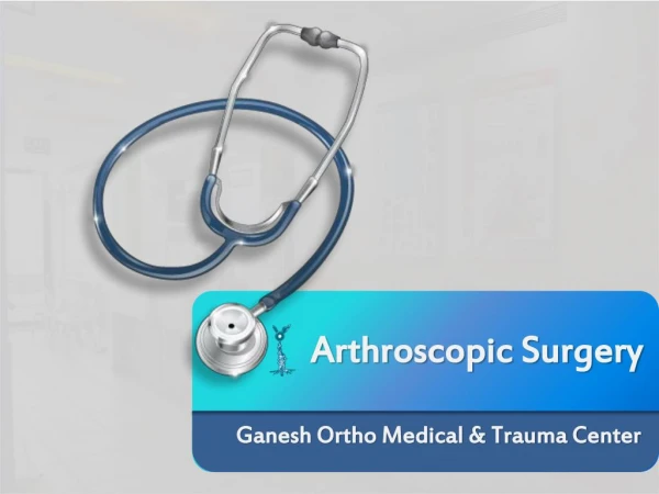 Important Factors to Look Into Arthroscopic Surgery