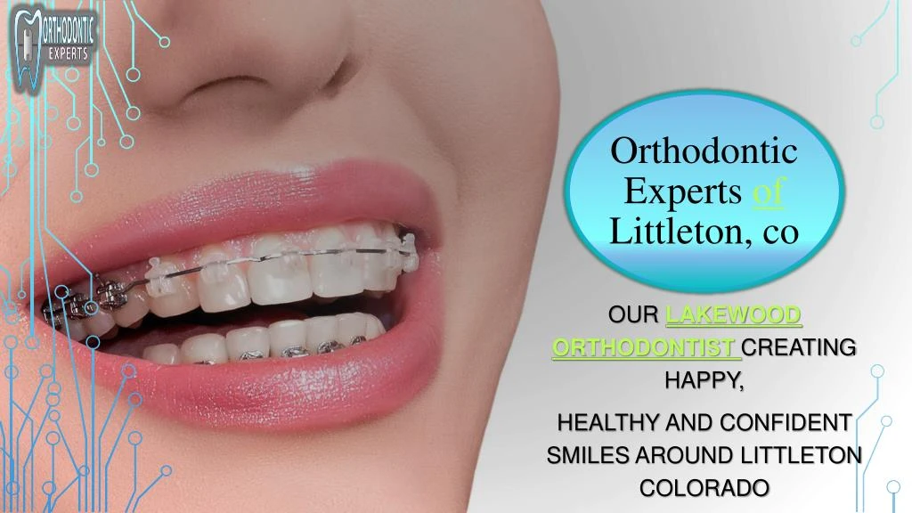 our lakewood orthodontist creating happy healthy and confident smiles around littleton colorado
