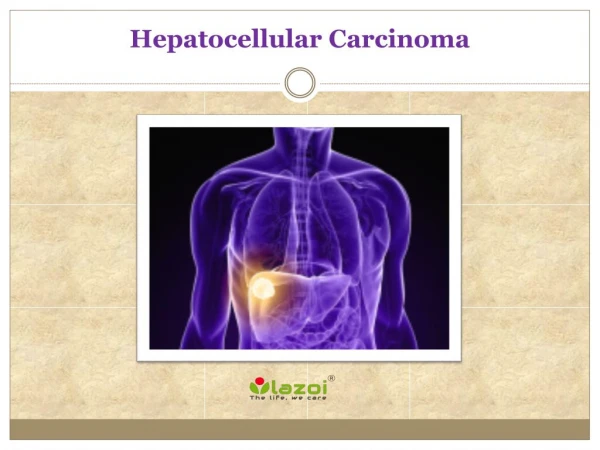 Hepatocellular Carcinoma: Causes, Symptoms, Daignosis, Prevention and Treatment