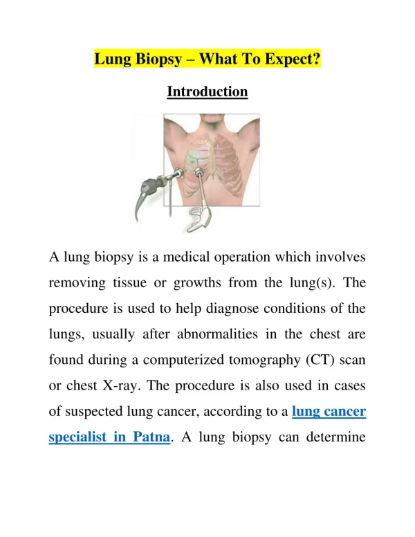 Lung Biopsy – What To Expect?