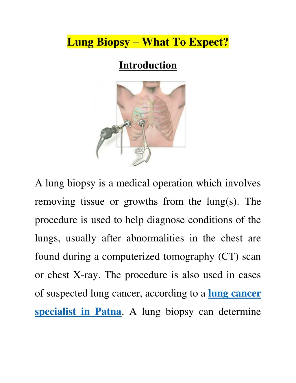 lung biopsy what to expect