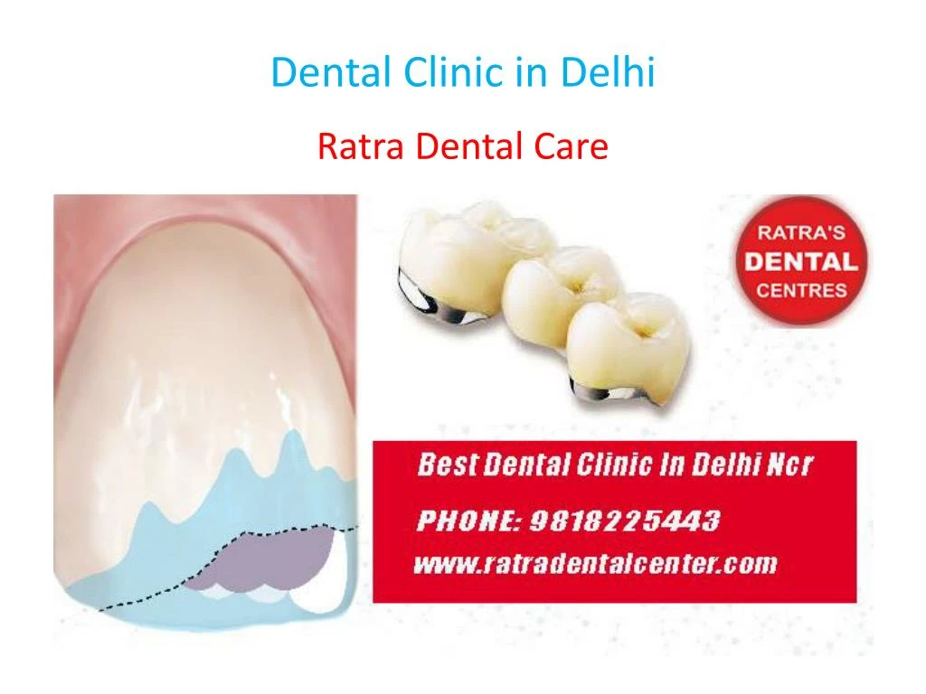dental clinic in delhi