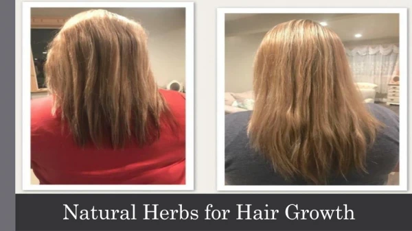 Most Beneficial Natural Herbs for Hair Growth