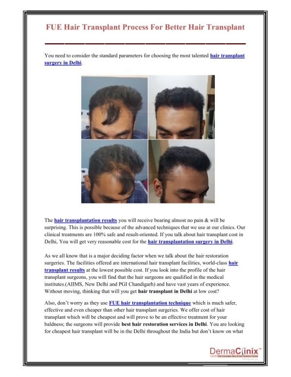 FUE Hair Transplant Process For Better Hair Transplant