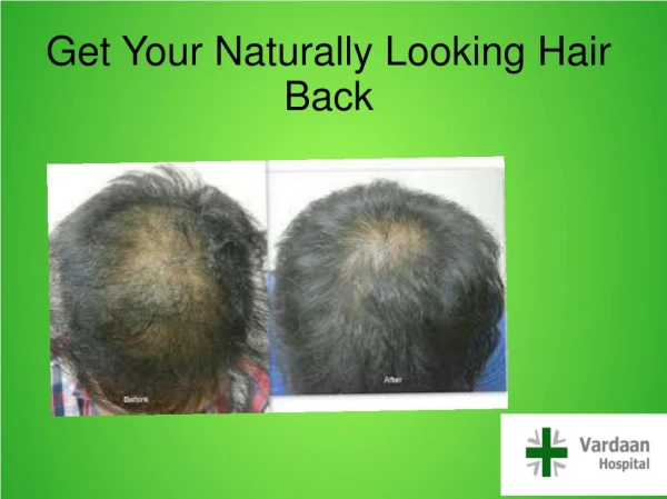 Get Your Naturally Looking Hair Back
