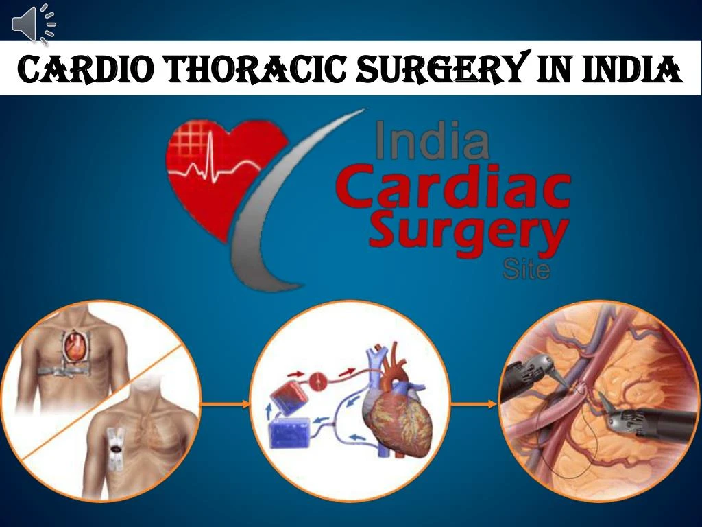 cardio thoracic surgery in india