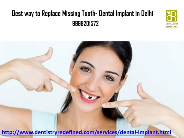 Best Way to Replace Missing Tooth- Dental Implant in Delhi
