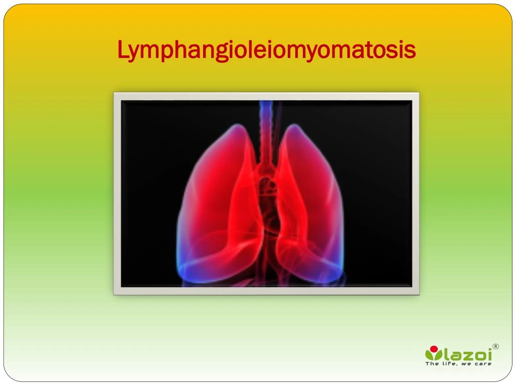lymphangioleiomyomatosis