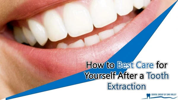 How to Best Care for Yourself After a Tooth Extraction