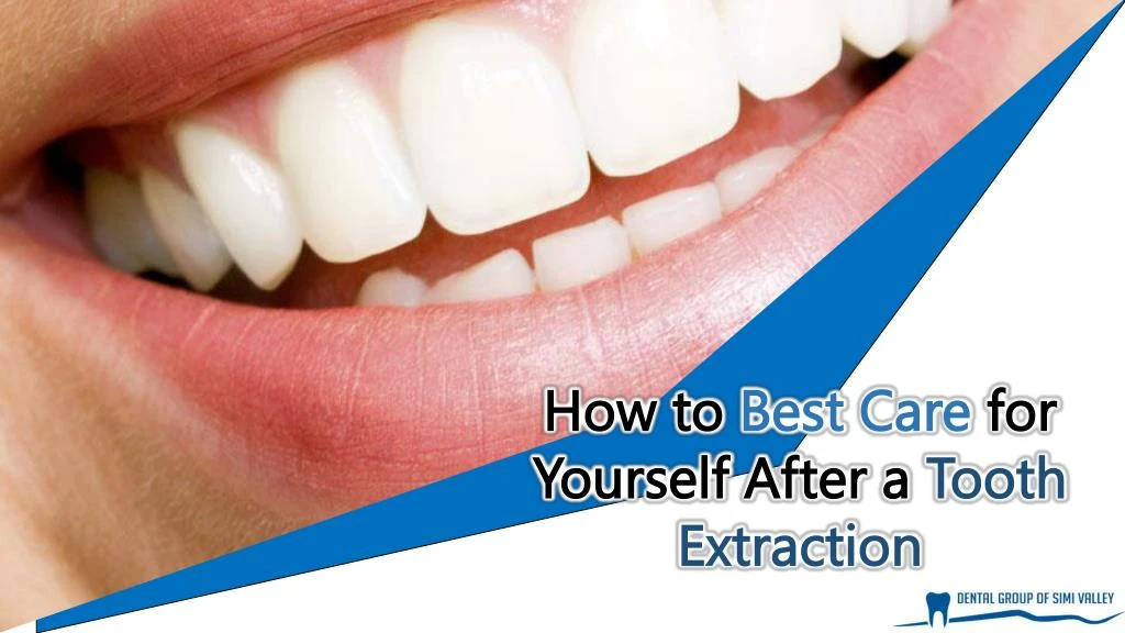 how to best care for yourself after a tooth