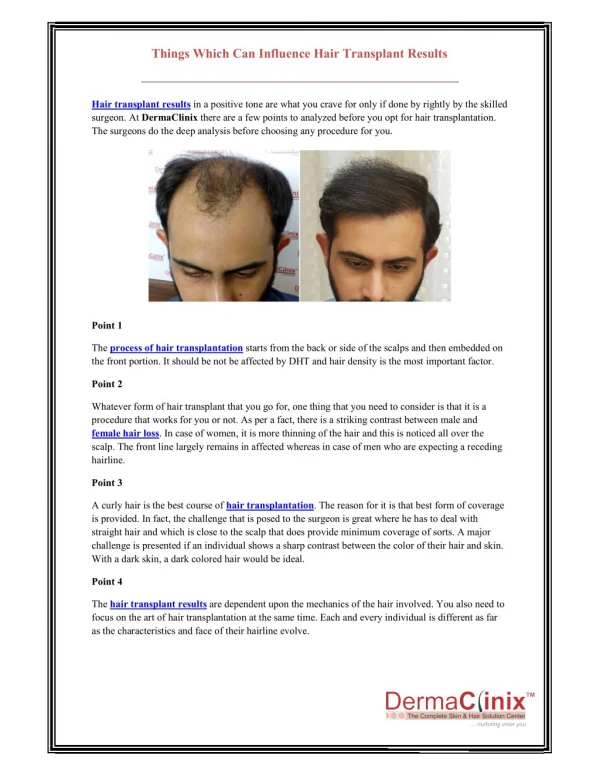 Things Which Can Influence Hair Transplant Results