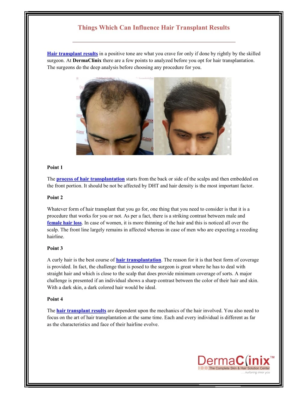things which can influence hair transplant results