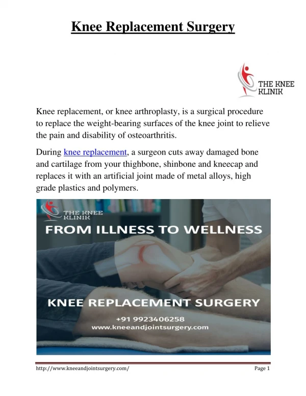 PDF | Best Knee Replacement Surgery in Pune by Dr Anshu Sachdev