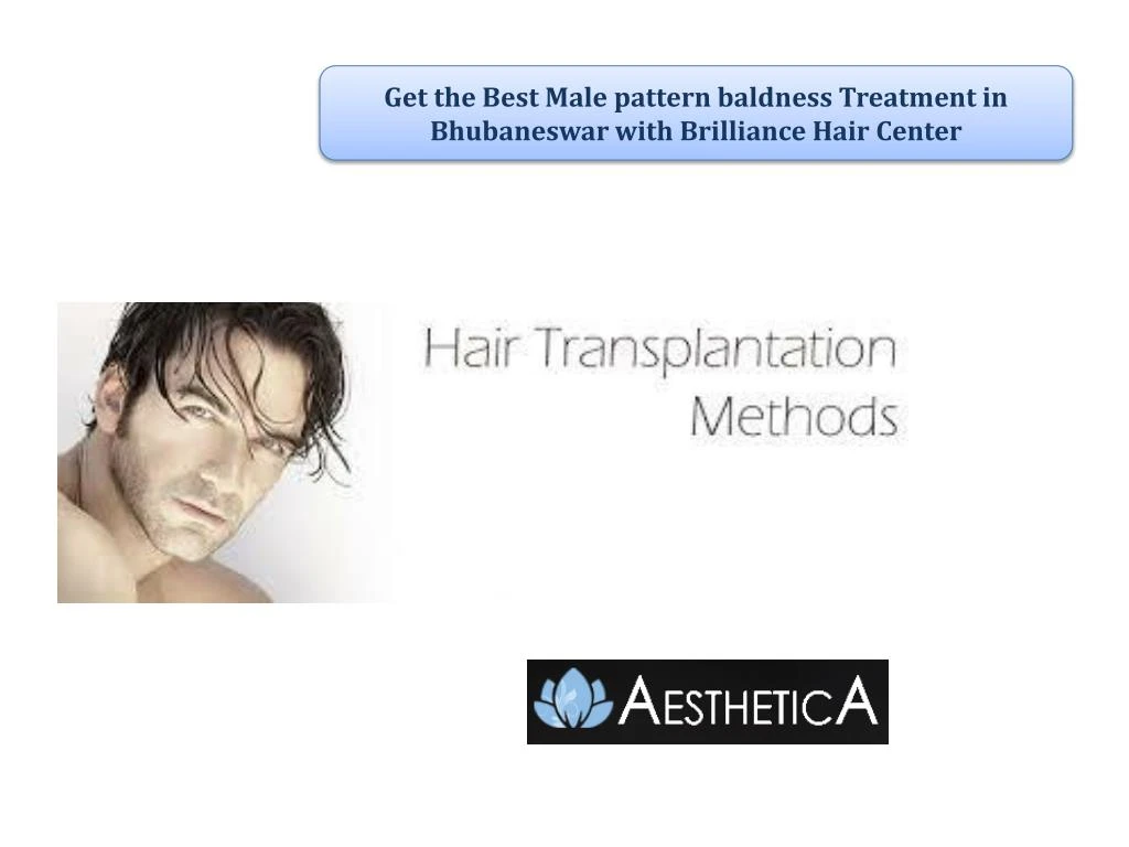 get the best male pattern baldness treatment