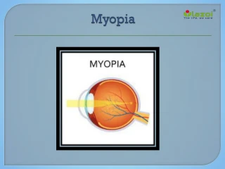 Myopia: Causes, Symptoms, Daignosis, Prevention and Treatment - slide 1