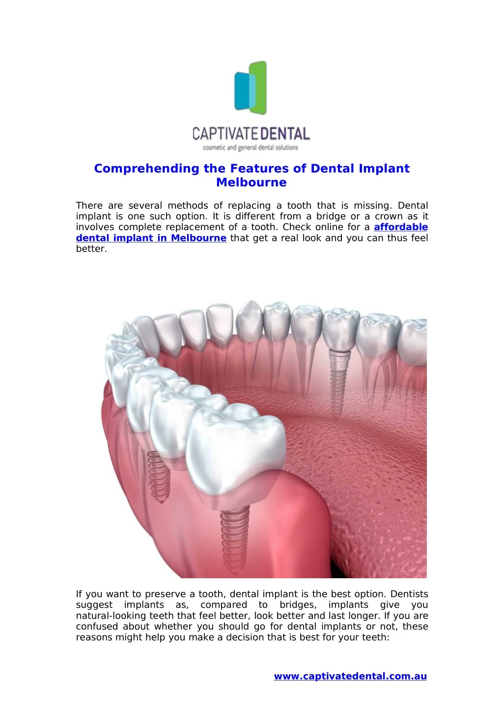 comprehending the features of dental implant