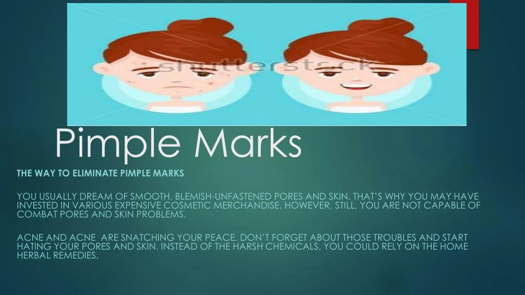 pimple marks