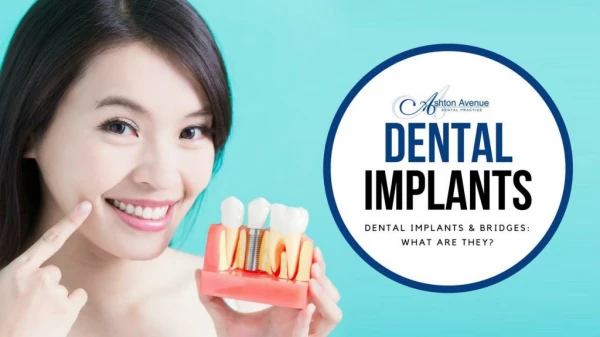 Dental Implants & Bridges: What Are They?