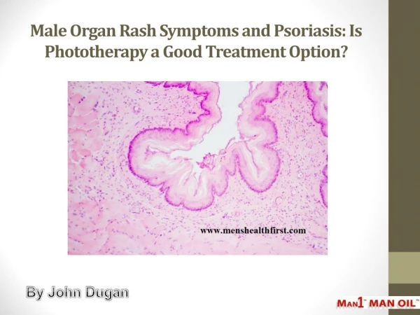 Male Organ Rash Symptoms and Psoriasis: Is Phototherapy a Good Treatment Option?