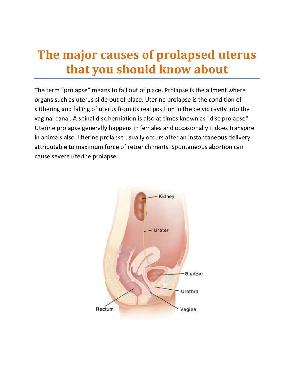 the major causes of prolapsed uterus that
