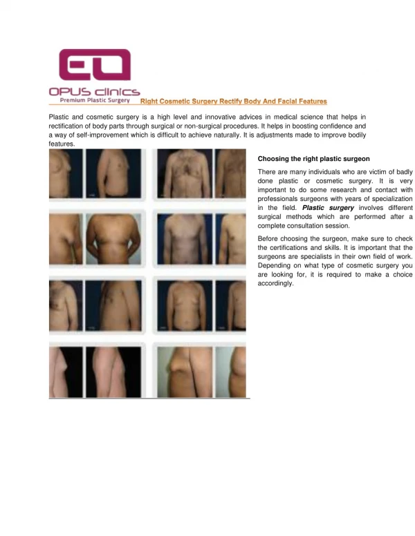 Right Cosmetic Surgery Rectify Body AndFacial Features