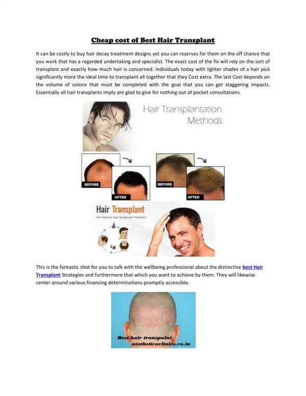 Cheap cost of Best Hair Transplant