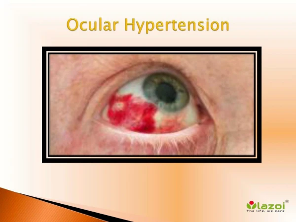 Ocular Hypertension: Causes, Symptoms, Daignosis, Prevention and Treatment