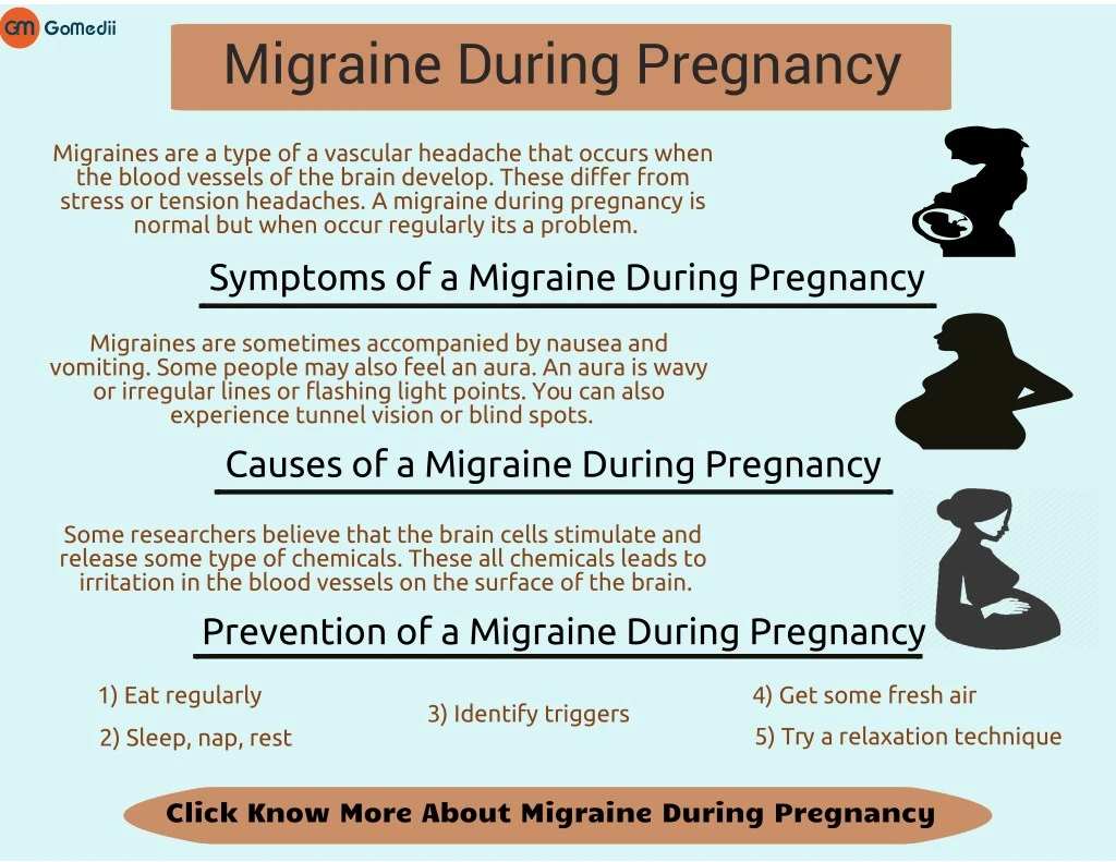 migraine during pregnancy