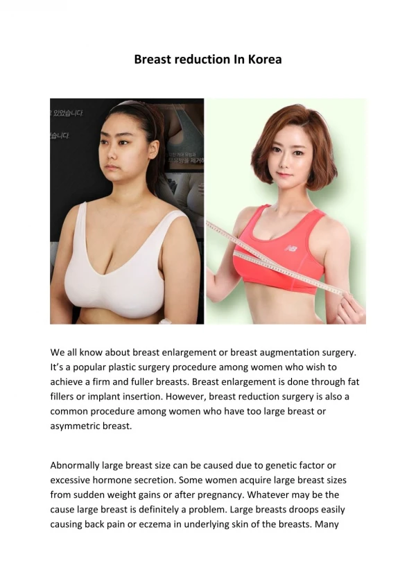 Know About The Breast Reduction In Korea