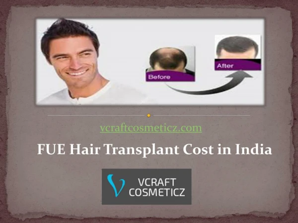 FUE Hair Transplant Cost in India