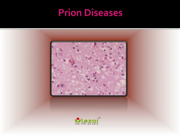 Prion Disease: Causes, Symptoms, Daignosis, Prevention and Treatment