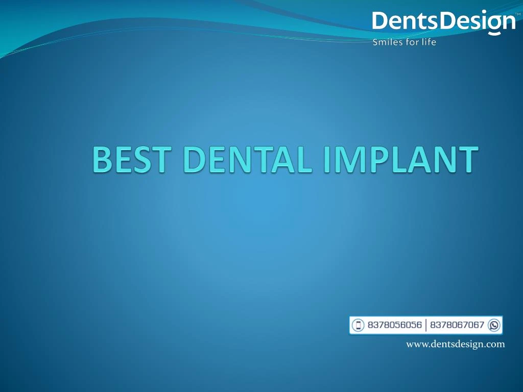 best dental implant