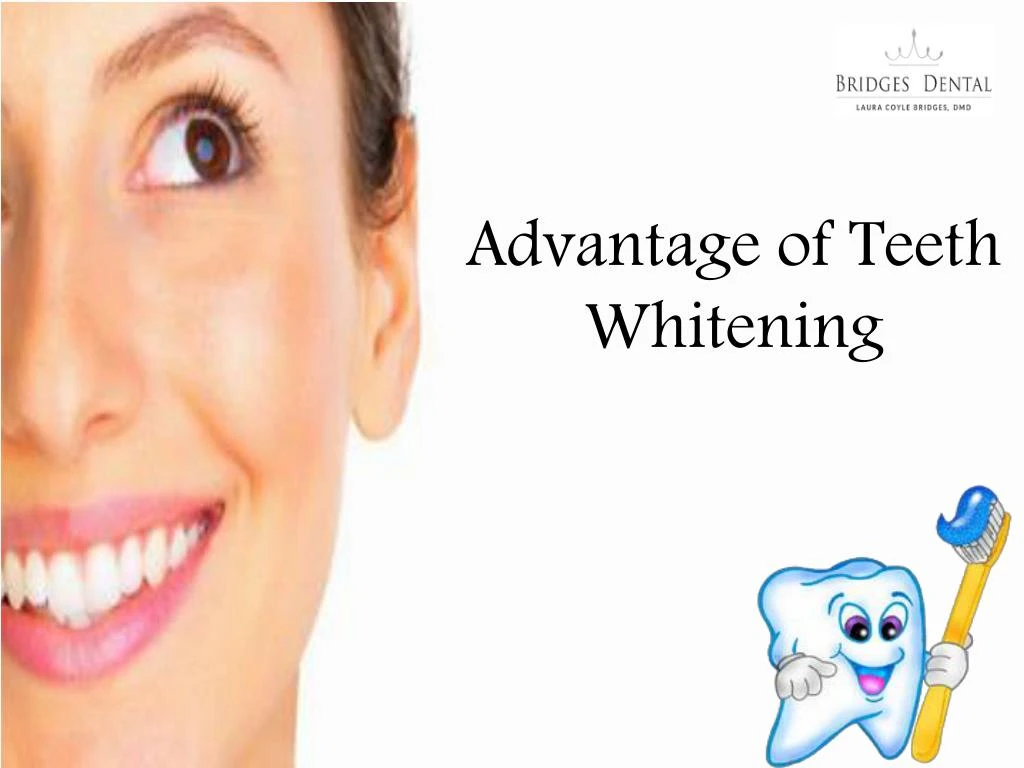 advantage of teeth whitening