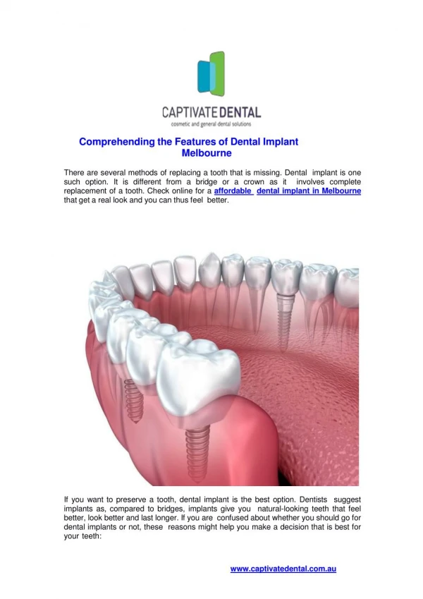 Comprehending the Features of Dental Implant Melbourne