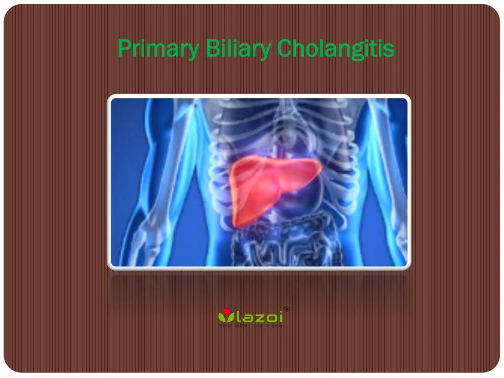 primary biliary cholangitis