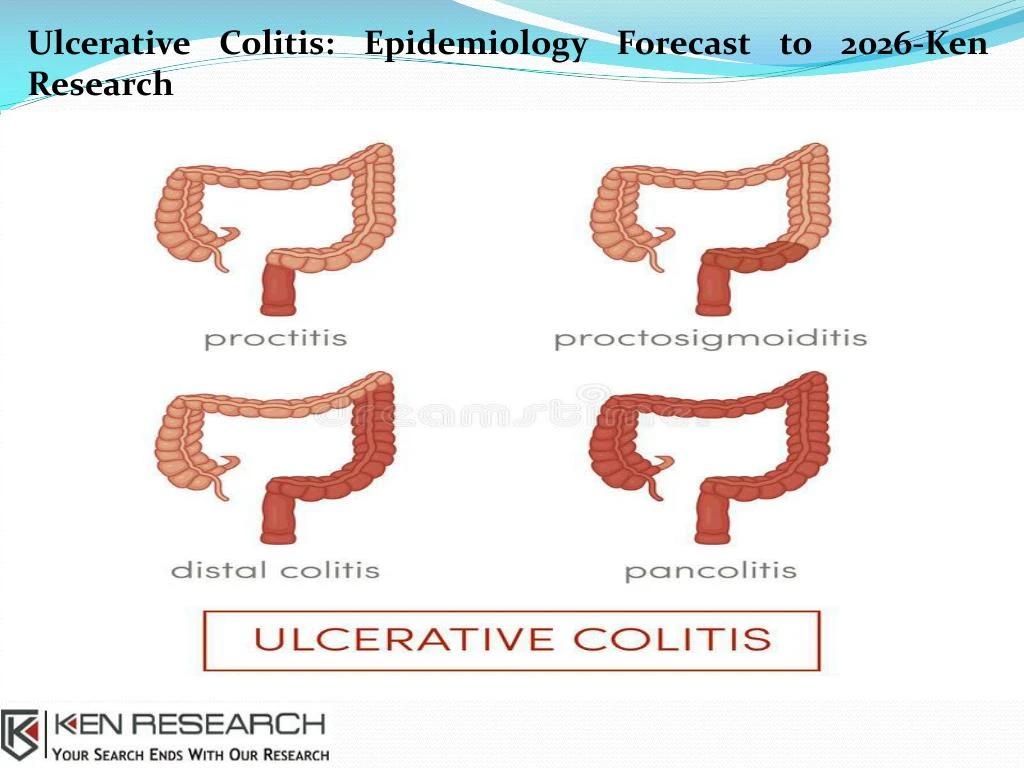 ulcerative colitis epidemiology forecast to 2026