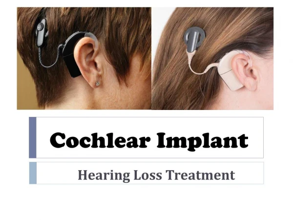 Cost of cochlear implant in India