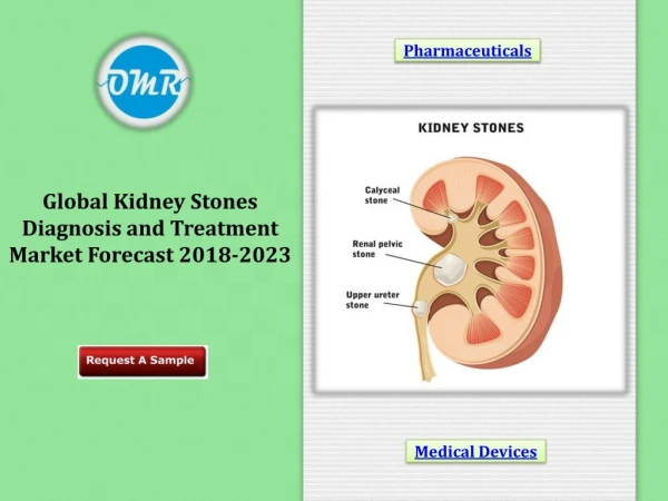 Kidney Stones Diagnosis and Treatment Market