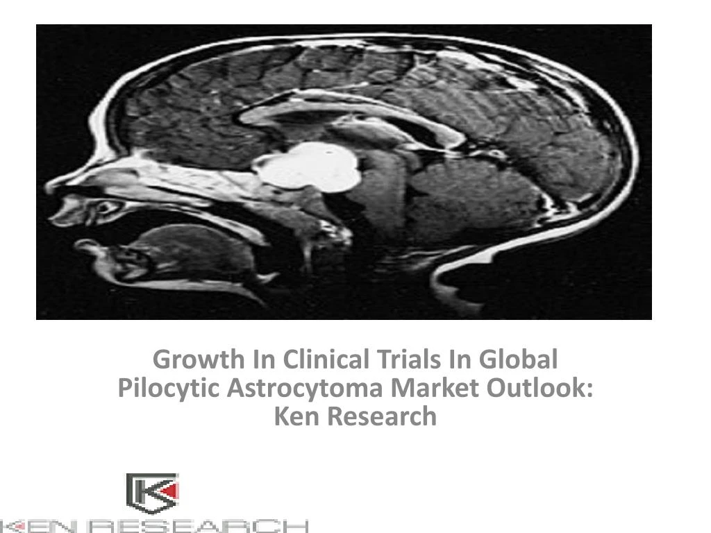 growth in clinical trials in global pilocytic astrocytoma market outlook ken research