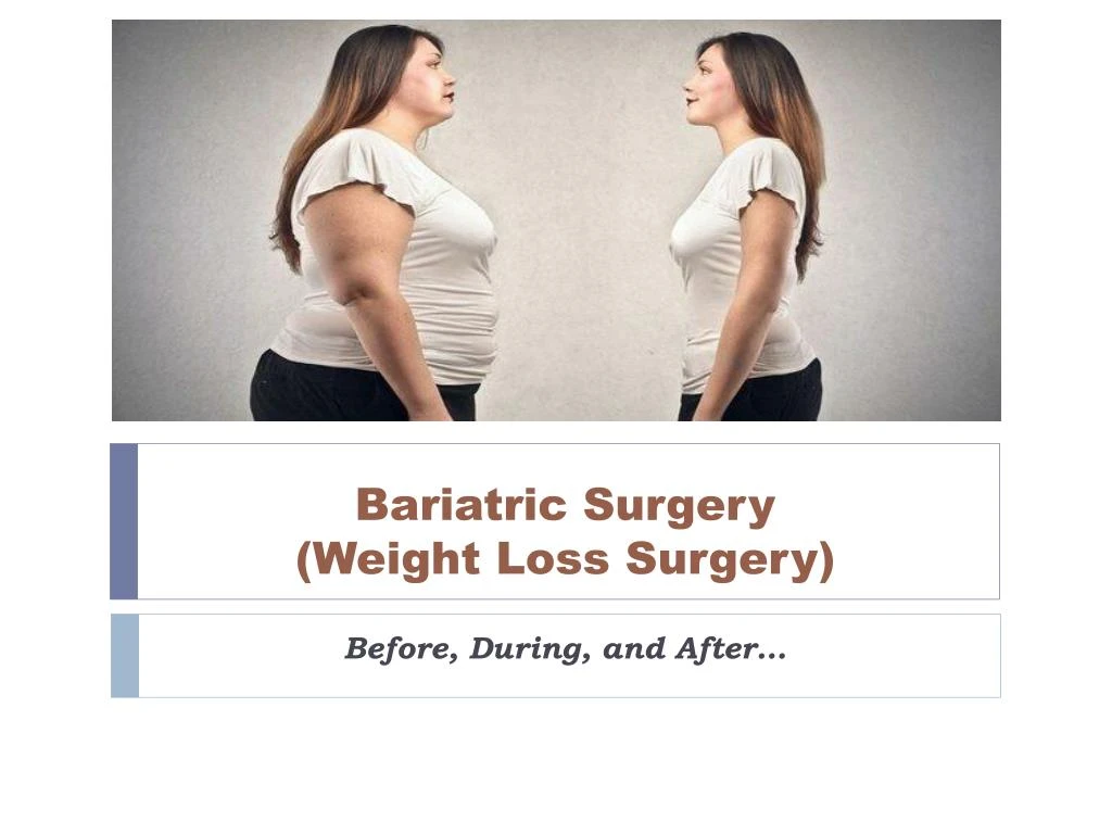 bariatric surgery weight loss surgery