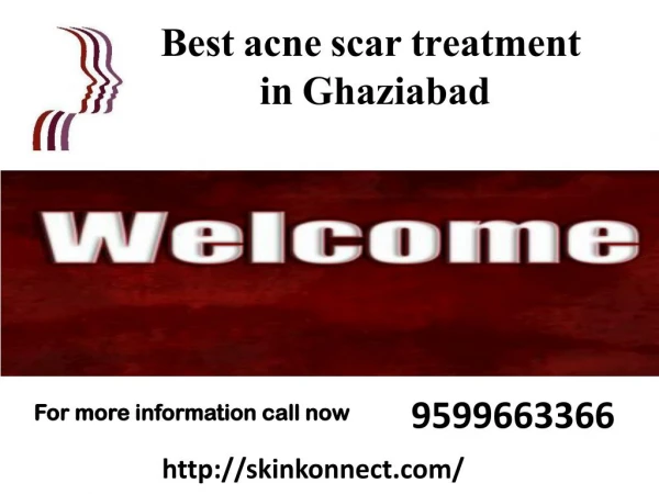 for more information call now