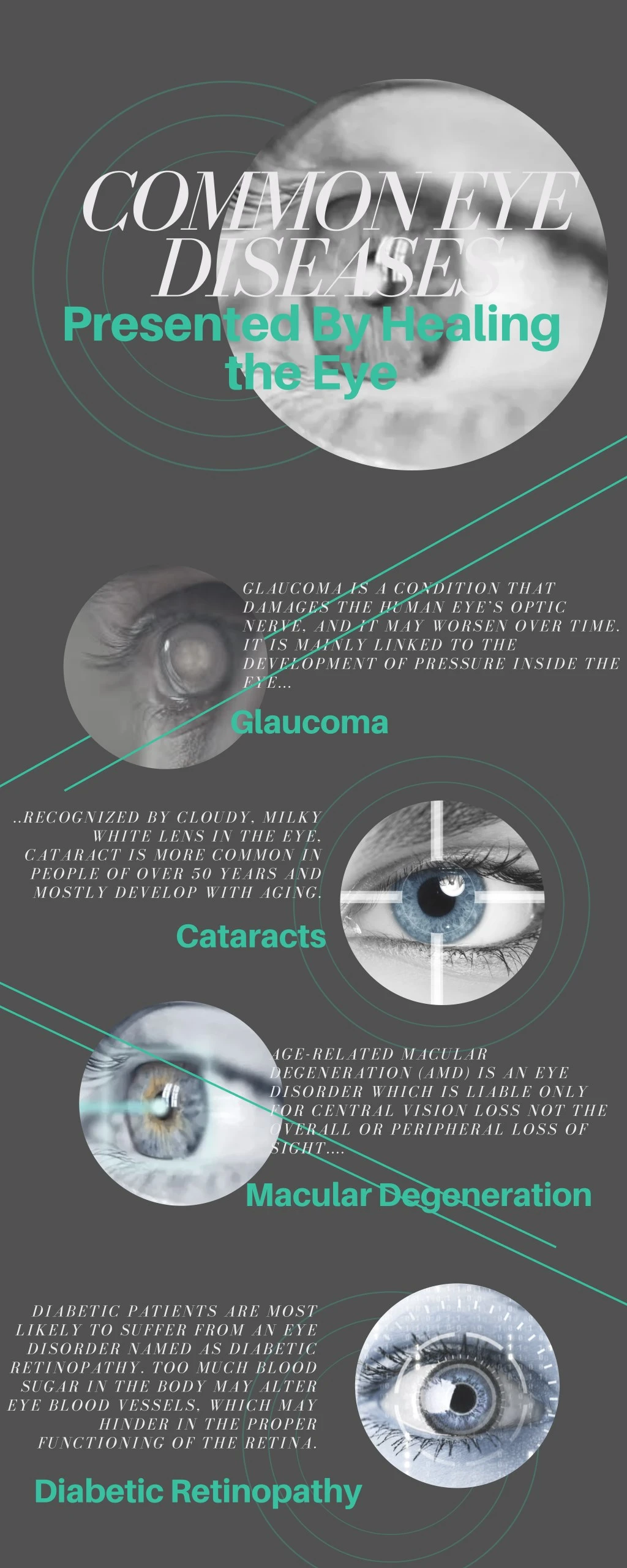 common eye diseases presented by healing the eye