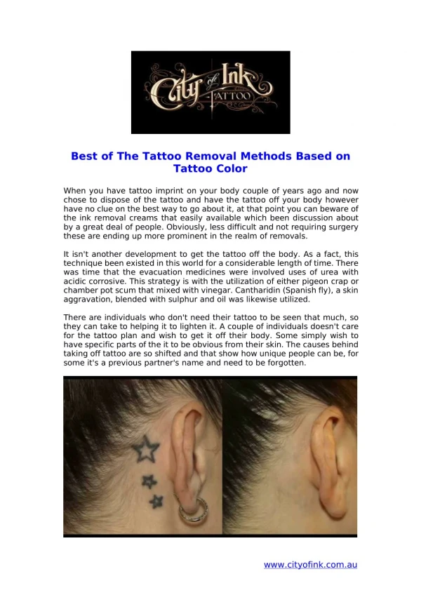 Best of The Tattoo Removal Techniques Based on Tattoo colour
