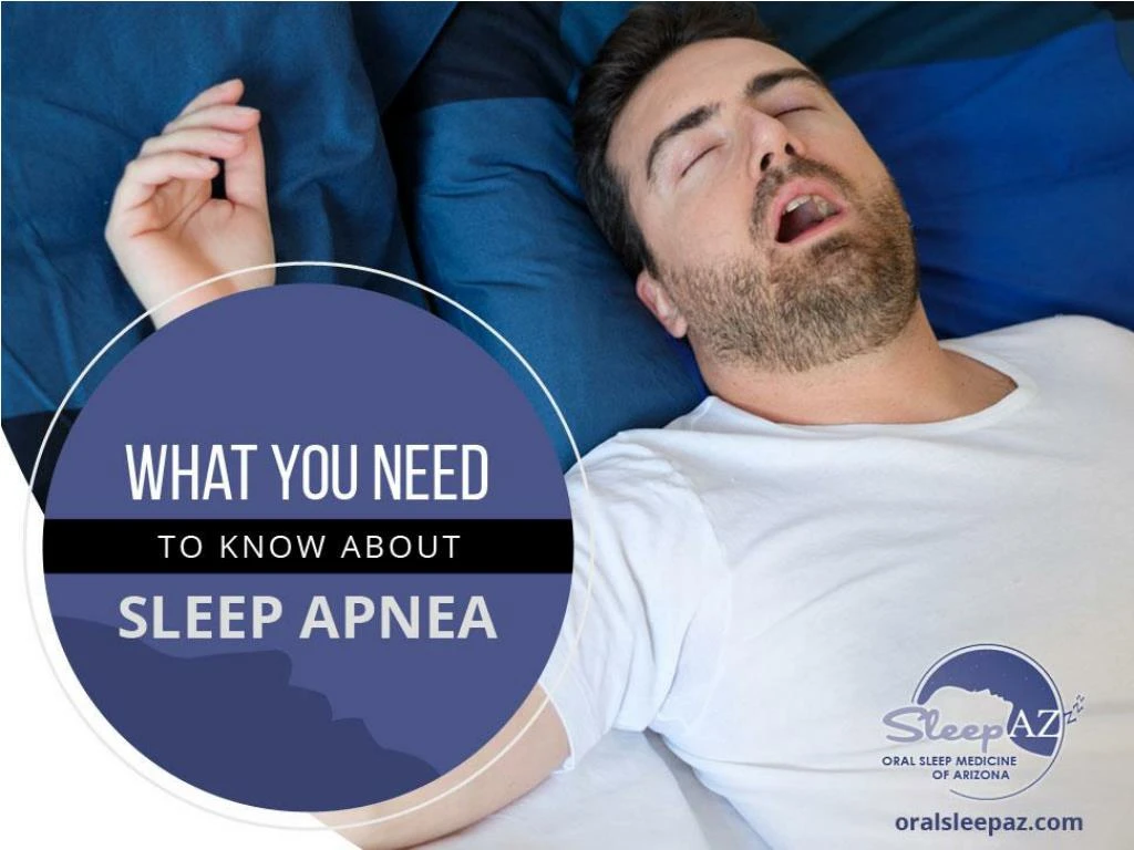 what you need to know about sleep apnea