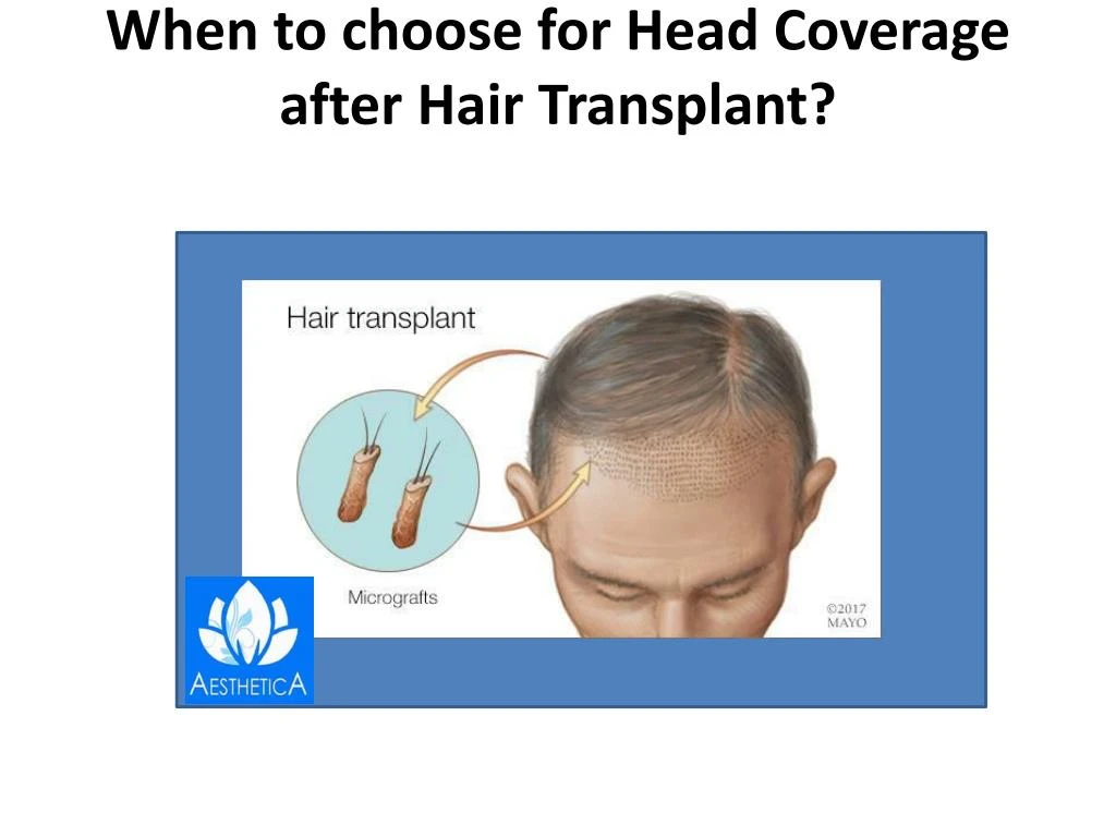when to choose for head coverage after hair transplant