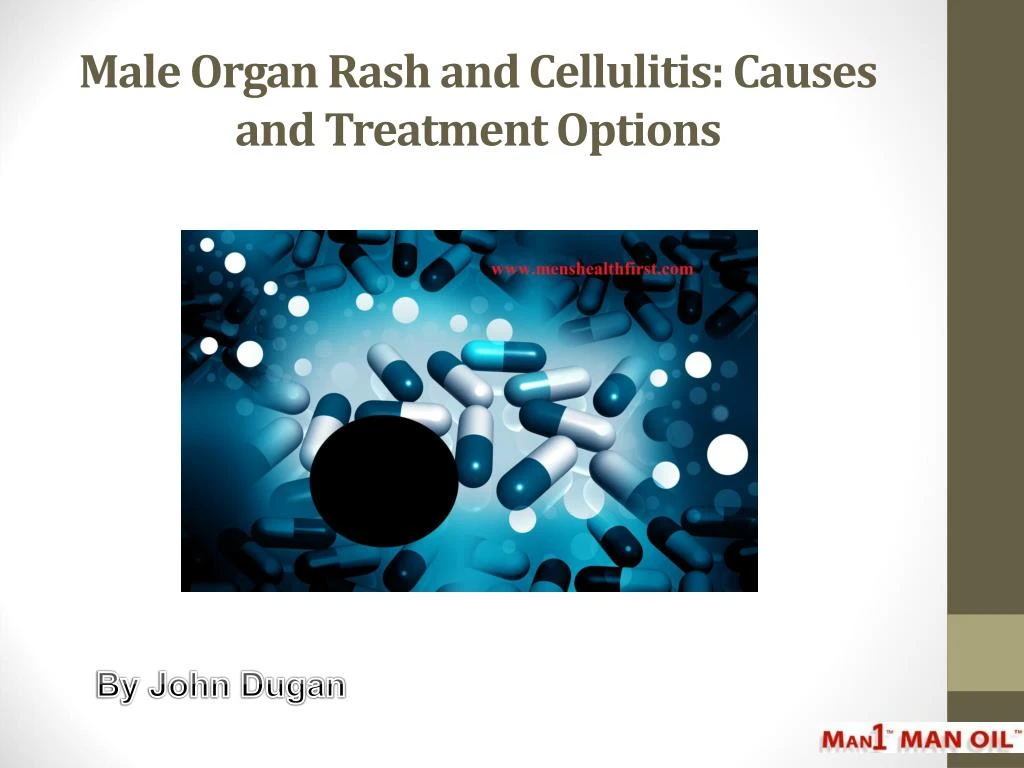 male organ rash and cellulitis causes and treatment options